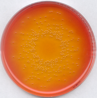 DEOXYCHOLATE LACTOSE AGAR FOR MICROBIOLO